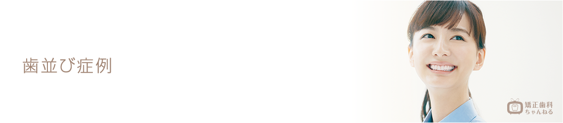 矯正歯科治療の種類